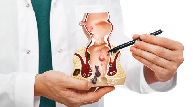 Piles Treatment